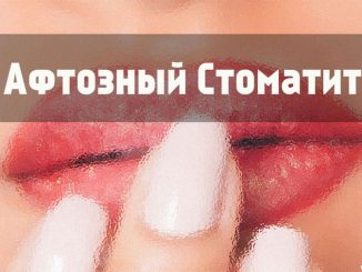 Что следует знать про афтозный стоматит: Симптомы, причины и лечение болезни